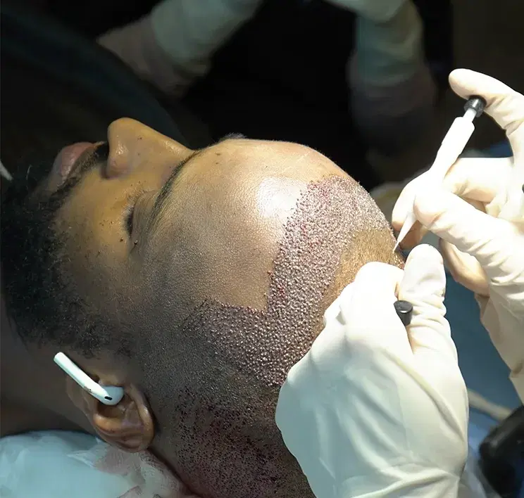 About Us Esthetic Hair