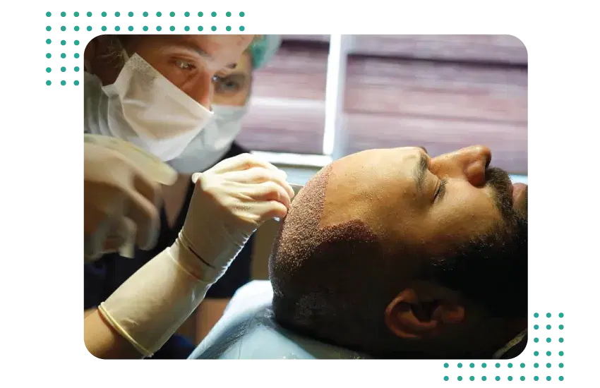 DHI Hair Transplant